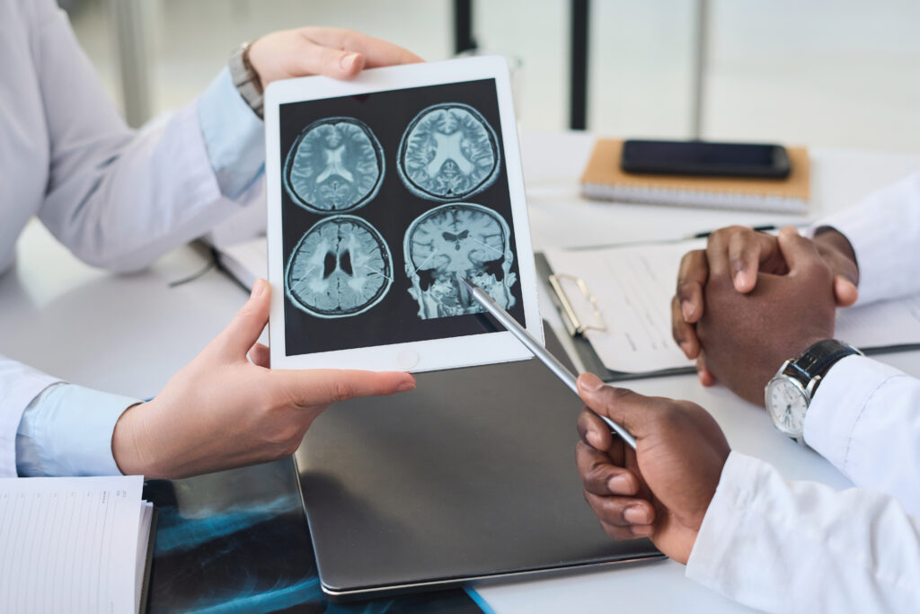 Doctors discussing brain tomography in team