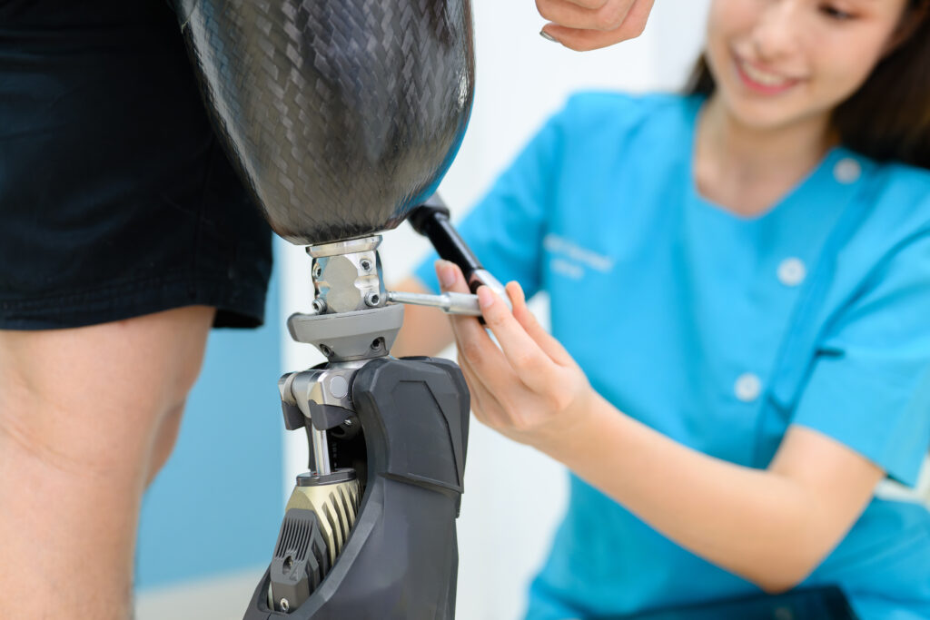 Physiotherapist adjusting prosthetic leg of patient in hospital, Disabled patient with treatment at health care center, New artificial limb production for disabled people